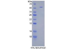 SDS-PAGE analysis of Mouse Androgen Receptor Protein.