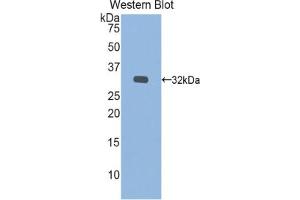 Western blot analysis of the recombinant protein. (IDS anticorps  (AA 180-448))