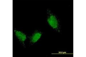 Image no. 1 for anti-Titin (TTN) (AA 1-111) antibody (ABIN598990) (Titin anticorps  (AA 1-111))