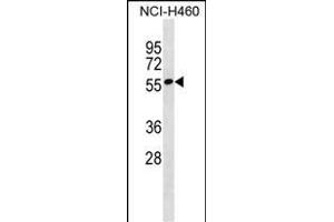 ZN Antibody (N-term) (ABIN1539437 and ABIN2849988) western blot analysis in NCI- cell line lysates (35 μg/lane). (ZNF302 anticorps  (N-Term))