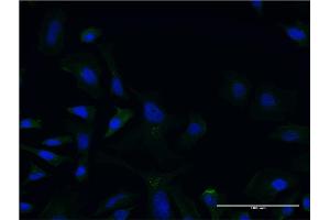 Immunofluorescence of monoclonal antibody to LCAT on HeLa cell.