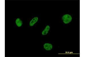 Immunofluorescence of purified MaxPab antibody to BAP1 on HeLa cell. (BAP1 anticorps  (AA 1-729))