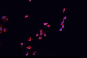 ABIN6266609 staining HEK 293 cells by IF/ICC. (CDKN2B anticorps  (Internal Region))