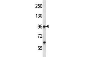 Tie1 antibody western blot analysis in K562 lysate. (TIE1 anticorps  (AA 361-389))