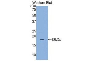 Western Blotting (WB) image for anti-Retinol Binding Protein 1, Cellular (RBP1) (AA 1-135) antibody (ABIN1860410) (RBP1 anticorps  (AA 1-135))