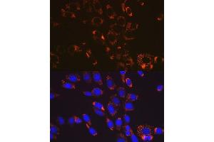 Immunofluorescence analysis of NIH-3T3 cells using SOD2 antibody (ABIN7270638).
