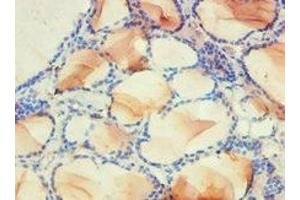Immunohistochemistry of paraffin-embedded human thyroid tissue using ABIN7142339 at dilution of 1:100