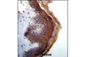 IL1F5 Antibody (N-term) (ABIN656238 and ABIN2845554) immunohistochemistry analysis in formalin fixed and paraffin embedded human skin tissue followed by peroxidase conjugation of the secondary antibody and DAB staining.