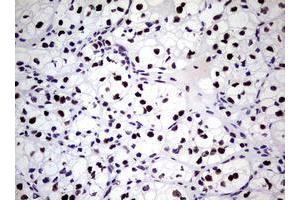 Image no. 11 for anti-Nibrin (NBN) (AA 183-460) antibody (ABIN1491066)