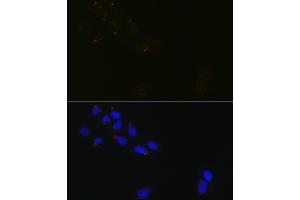 Immunofluorescence analysis of U-2 OS cells using GR Rabbit mAb (ABIN1679751, ABIN3015980, ABIN3015981 and ABIN7101472) at dilution of 1:100 (40x lens). (GORASP1 anticorps)