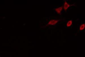 ABIN6274837 staining HeLa cells by IF/ICC. (AMPD2 anticorps  (N-Term))