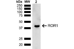 Western blot analysis of Rat Kidney showing detection of ~43 kDa ROR1 protein using Rabbit Anti-ROR1 Polyclonal Antibody (ABIN5667808). (ROR1 anticorps  (AA 200-300) (PE))