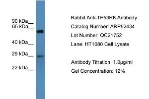 WB Suggested Anti-TP53RK  Antibody Titration: 0. (TP53RK anticorps  (N-Term))