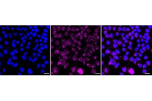 Immunocytochemical staining of HepG2 cells with HRAS antibody (ABIN7799002), 1:1,000). (Recombinant HRAS anticorps)