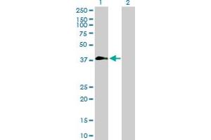 Western Blot analysis of ZNF557 expression in transfected 293T cell line by ZNF557 MaxPab polyclonal antibody. (ZNF557 anticorps  (AA 1-375))