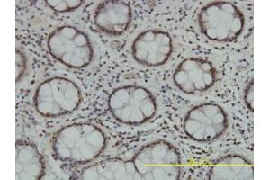 Image no. 1 for anti-Tousled-Like Kinase 2 (TLK2) (AA 1-126) antibody (ABIN599164) (TLK2 anticorps  (AA 1-126))