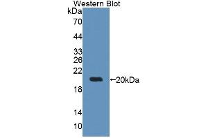 Figure. (DTYMK anticorps  (AA 43-190))