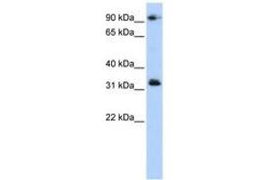 Image no. 1 for anti-Coiled-Coil Domain Containing 69 (CCDC69) (C-Term) antibody (ABIN6741306) (CCDC69 anticorps  (C-Term))