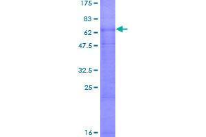 Image no. 1 for Solute Carrier Family 7 (Cationic Amino Acid Transporter, Y+ System), Member 9 (SLC7A9) (AA 1-487) protein (GST tag) (ABIN7540270)