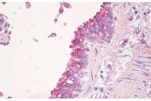 Image no. 2 for anti-Scavenger Receptor Class B, Member 2 (SCARB2) (AA 25-74) antibody (ABIN6749778)