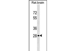 Rat Hoxd9 Antibody (Center) (ABIN1537807 and ABIN2849159) western blot analysis in rat brain tissue lysates (35 μg/lane). (HOXD9 anticorps  (AA 127-154))