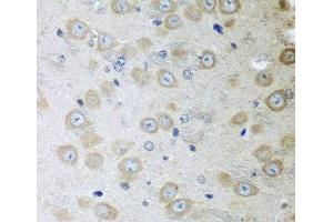 Immunohistochemistry of paraffin-embedded Mouse brain using ATAD3A Polyclonal Antibody at dilution of 1:100 (40x lens). (ATAD3A anticorps)
