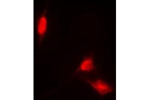 Immunofluorescent analysis of NRF2 staining in HL60 cells. (NRF2 anticorps  (C-Term))