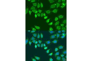 Immunofluorescence analysis of U2OS cells using L2HGDH antibody (ABIN7268160) at dilution of 1:100.