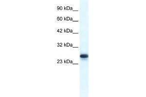WB Suggested Anti-HMGB1 Antibody Titration:  1. (HMGB1 anticorps  (Middle Region))