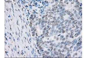 Immunohistochemical staining of paraffin-embedded Kidney tissue using anti-PSMA7mouse monoclonal antibody. (PSMA7 anticorps)
