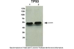 Sample Type: 1. (p53 anticorps  (N-Term))