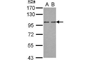 Western Blotting (WB) image for anti-Oxysterol Binding Protein 2 (OSBP2) (AA 596-835) antibody (ABIN1499917) (OSBP2 anticorps  (AA 596-835))