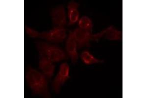 ABIN6275289 staining Hela by IF/ICC. (Nesprin3 anticorps  (N-Term))