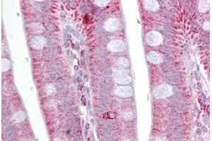 Anti-POSTN / Periostin antibody IHC staining of human small intestine.