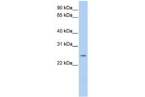 PARK7 antibody used at 1 ug/ml to detect target protein. (PARK7/DJ1 anticorps)