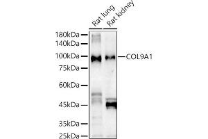 Western blot analysis of extracts of various cell lines, using COL9 Rabbit pAb antibody (ABIN6127648, ABIN6138849, ABIN6138851 and ABIN6222235) at 1:1000 dilution. (COL9A1 anticorps  (AA 20-270))