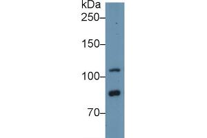 Detection of TLR5 in Human Hela cell lysate using Polyclonal Antibody to Toll Like Receptor 5 (TLR5)