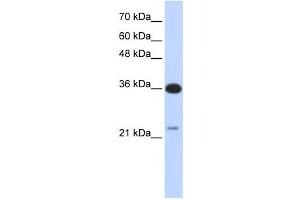 Western Blotting (WB) image for anti-TP53 Target 5 (TP53TG5) antibody (ABIN2459705) (TP53TG5 anticorps)