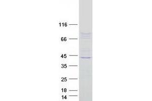 Validation with Western Blot