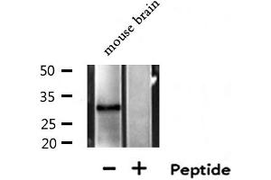 Western blot analysis of extracts from Mouse brain lysate, using MTAP antibody. (MTAP anticorps  (Internal Region))