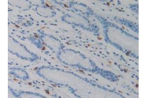 IHC-P analysis of Human Stomach Tissue, with DAB staining. (Resistin anticorps  (AA 17-108))