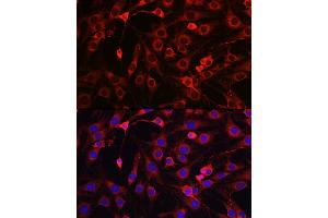 Immunofluorescence analysis of C6 cells using HMGCR Rabbit pAb (ABIN3022293, ABIN3022294, ABIN3022295, ABIN1513022 and ABIN6218714) at dilution of 1:100 (40x lens).