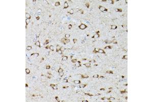 Immunohistochemistry of paraffin-embedded rat brain using GARS Rabbit pAb (ABIN6127942, ABIN6140964, ABIN6140966 and ABIN6221085) at dilution of 1:300 (40x lens).