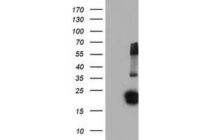 Western Blotting (WB) image for anti-Fibroblast Growth Factor 21 (FGF21) (AA 29-209) antibody (ABIN1491337) (FGF21 anticorps  (AA 29-209))