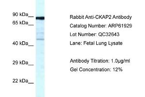 Western Blotting (WB) image for anti-Cytoskeleton Associated Protein 2 (CKAP2) (C-Term) antibody (ABIN2788952) (CKAP2 anticorps  (C-Term))