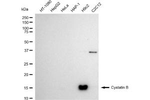 Western blotting analysis using Cystatin B antibody (ABIN7798237).