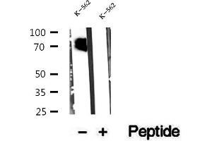 Western blot analysis of extracts of K-562 cells, using CMIP antibody. (CMIP anticorps  (C-Term))