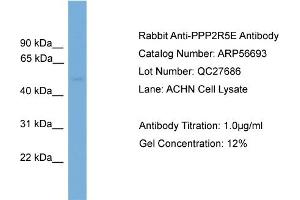 Western Blotting (WB) image for anti-Protein Phosphatase 2, Regulatory Subunit B', epsilon Isoform (PPP2R5E) (N-Term) antibody (ABIN2786846) (PPP2R5E anticorps  (N-Term))