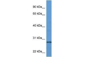 Western Blot showing PRTN3 antibody used at a concentration of 1 ug/ml against Fetal Lung Lysate (PRTN3 anticorps  (N-Term))