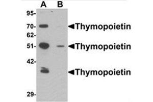 Western blot analysis of Thymopoietin in HeLa cell lysate with Thymopoietin Antibody  at 0. (Thymopoietin anticorps  (N-Term))
